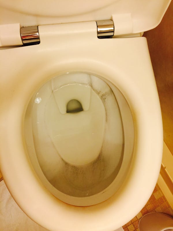 Dirty Stained Toilet - Adventure of the Seas